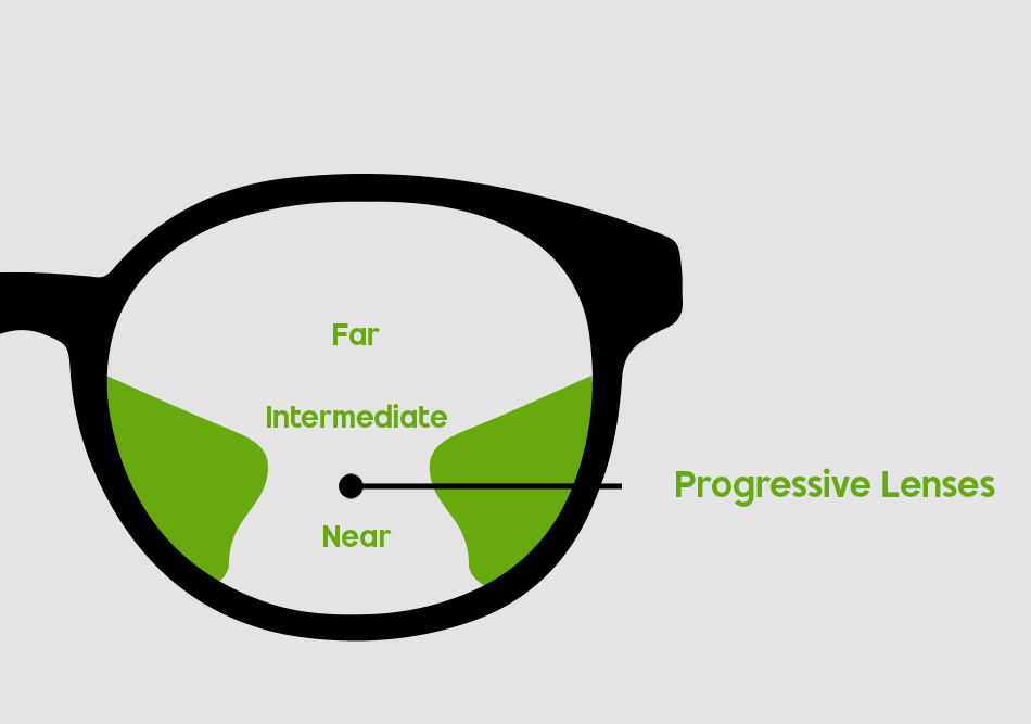 Progressive
